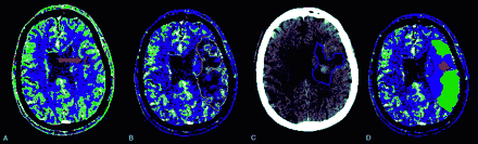 Fig 1.