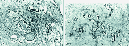Fig 2.