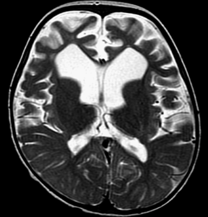 Fig 4.