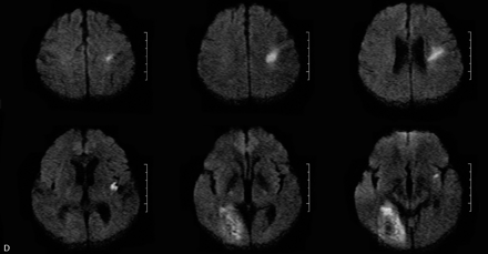Fig 2.