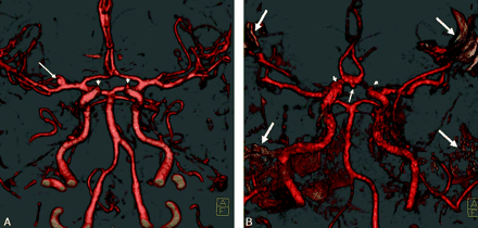 Fig 2.