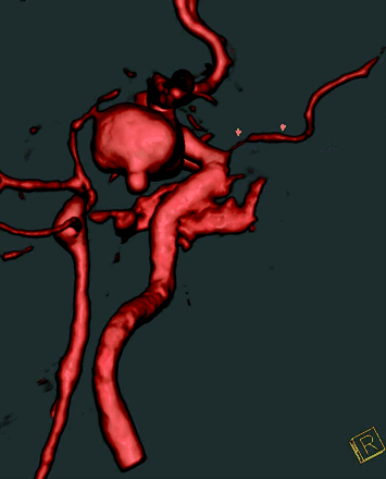 Fig 3.