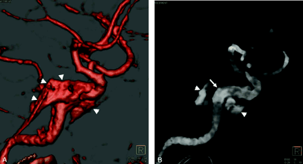 Fig 4.