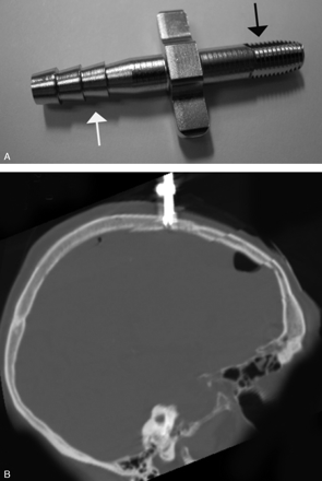 Fig 1.