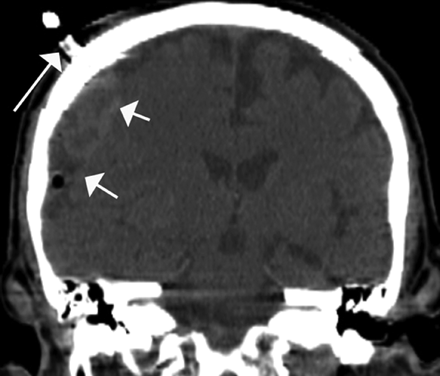 Fig 3.