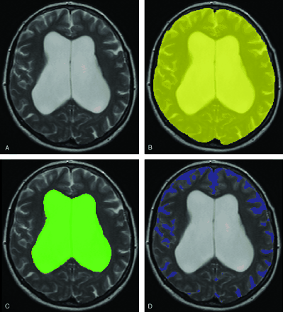 Fig 1.