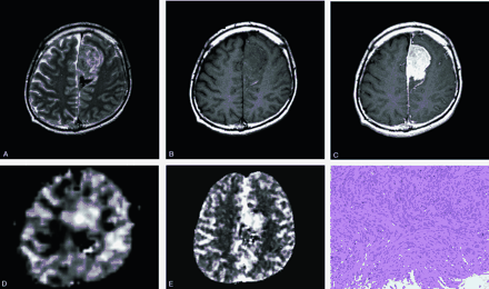 Fig 4.