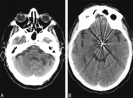 Fig 1.