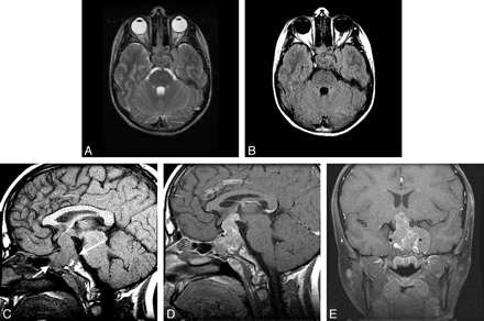 Fig 1.