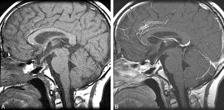 Fig 3.