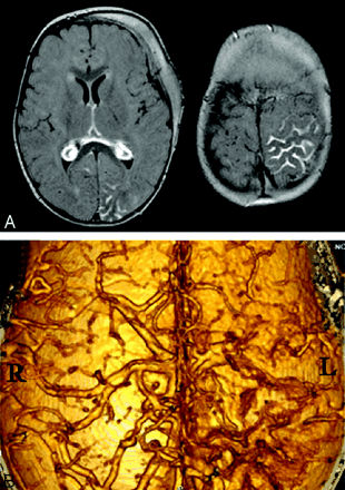 Fig 3.