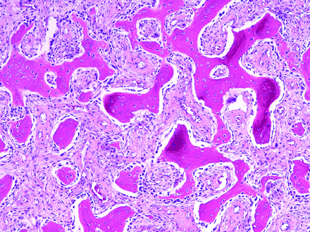 Fig 4.