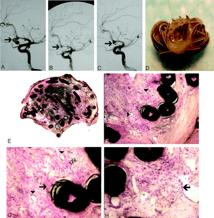 Fig 3.