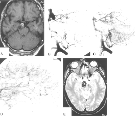 Fig 3.