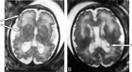 Fig 1.