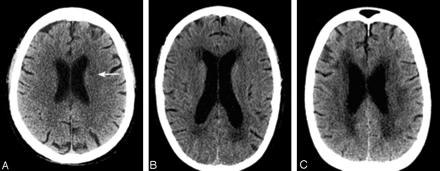 Fig 2.