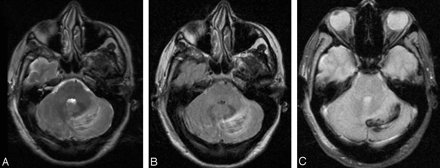 Fig 1.