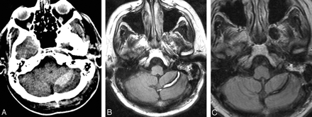 Fig 2.