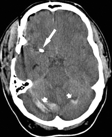 Fig 3.