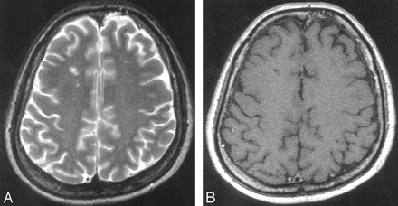 Fig 4.