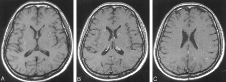 Fig 5.