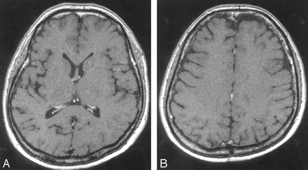 Fig 6.
