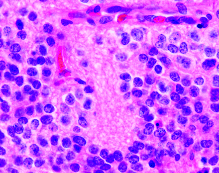 Fig 12.