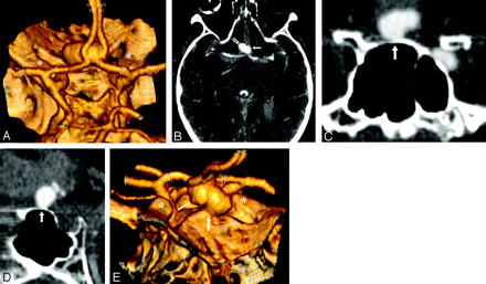 Fig 1.