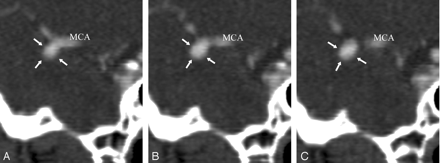 Fig 2.