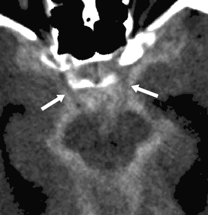 Fig 4.