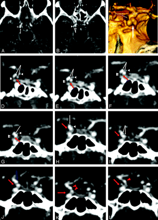 Fig 5.
