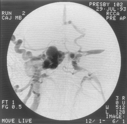 Fig 1.