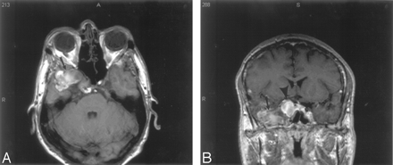 Fig 3.