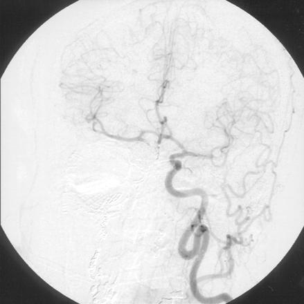 Fig 6.