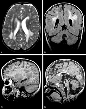 Fig 2.