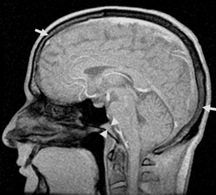 Fig 1.