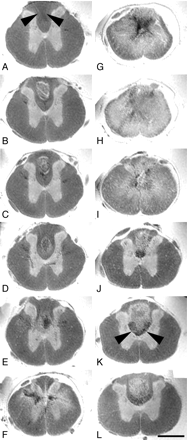 Fig 2.