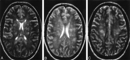 Fig 1.