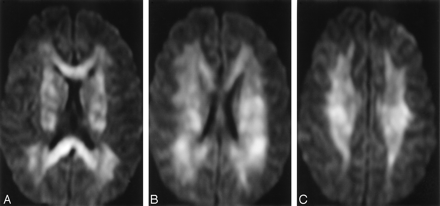 Fig 2.