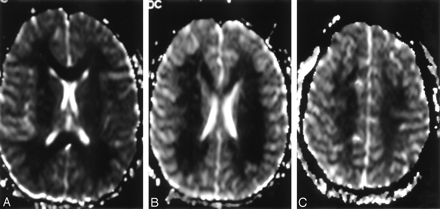 Fig 3.