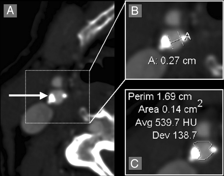 Fig 3.