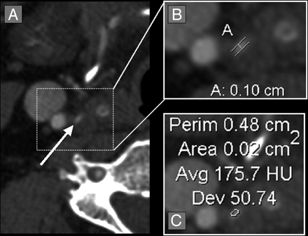 Fig 5.