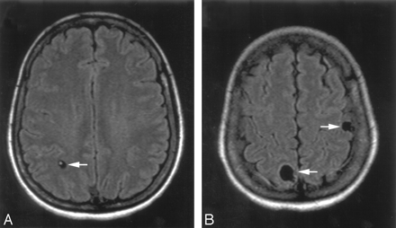 Fig 1.