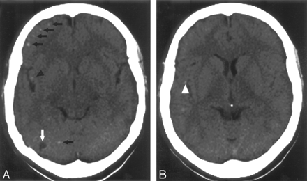 Fig 3.