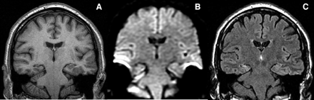 Fig 3.