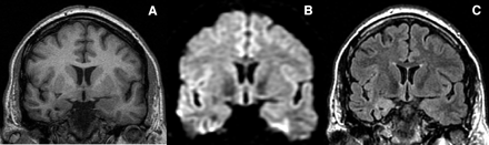 Fig 4.
