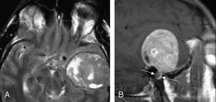 Fig 5.