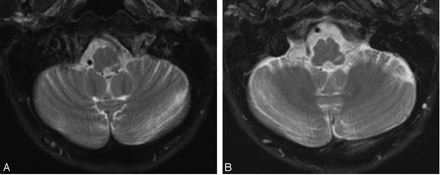 Fig 1.