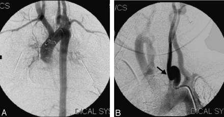 Fig 1.