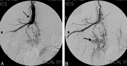 Fig 3.
